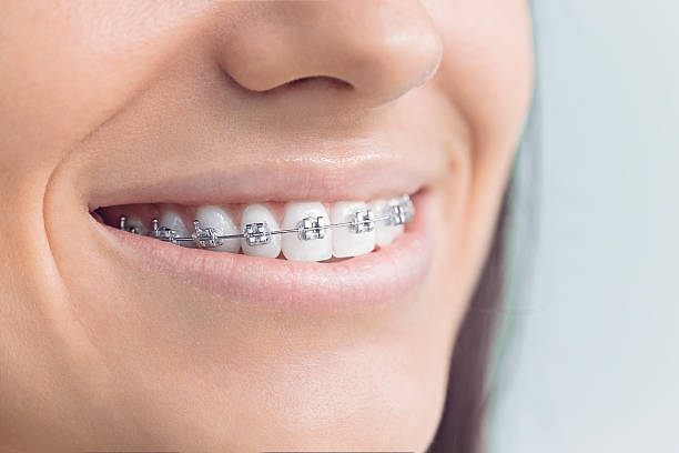 Why Choose Us for Your Dental Needs in Columbiana, OH